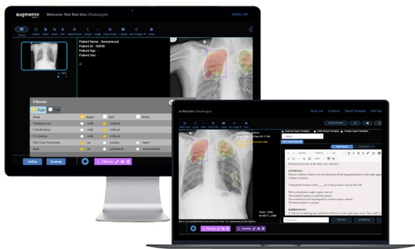 Image: Augmento X-Ray reduces radiologist workload by an impressive 30-50% (Photo courtesy of DeepTek.ai, Inc.) Image: Augmento X-Ray reduces radiologist workload by an impressive 30-50% (Photo courtesy of DeepTek.ai, Inc.)